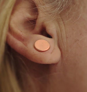 Rose Gold keloid pressure earrings • Magnetic earrings clip on ear rings • Cheloid compression earring • Post Op treatment keloid scars
